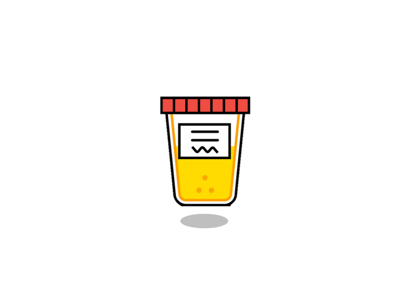 Amphetamines - Urine